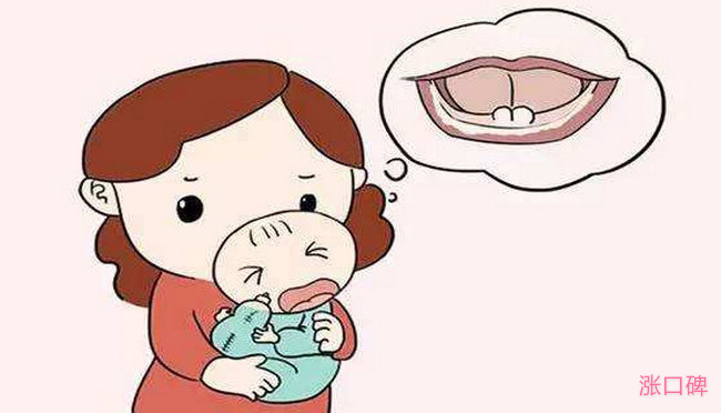 女婴出生长两颗牙 妈妈喂奶可遭了殃